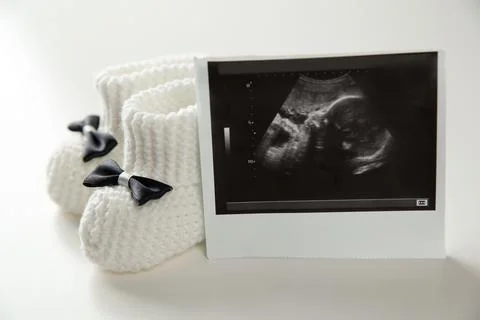 Happy Pregnant Woman and Her Husband Looking Ultrasound Scan Photo