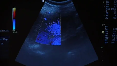 Ultrasound test Video stock 76950933