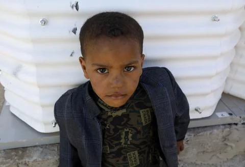 UN aid programs in Yemen need 3.9 billion US dollar throughout 2022, Sanaa - 11  Stock Photos