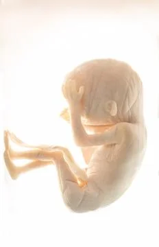 Unborn fetus in formalin solution, medical research Stock Photos