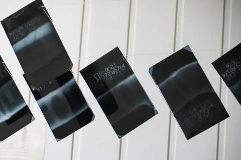 Unbrakable control. X-rays of the welds of the process pipeline at the petroc Stock Photos