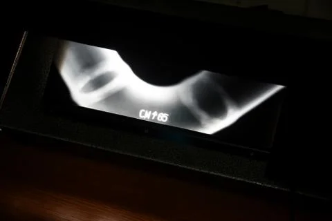 Unbrakable control. X-rays of the welds of the process pipeline at the petroc Stock Photos