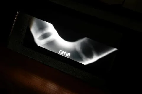 Unbrakable control. X-rays of the welds of the process pipeline at the petroc Stock Photos