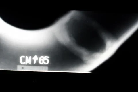 Unbrakable control. X-rays of the welds of the process pipeline at the petroc Stock Photos