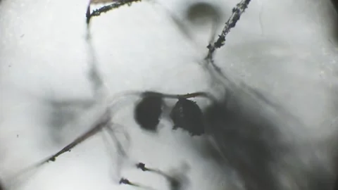 Under the microscope, black bread mold displays clear thread-like structure.. Vidéo 295032362