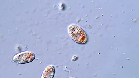 Under the Microscope: Ciliophora Protozoa in Motion,  400x 動画素材 317886939