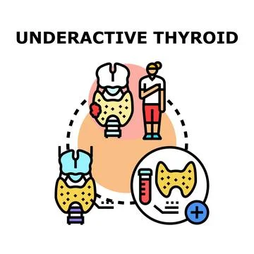 Underactive thyroid concept showing gland and medical examination Illustration