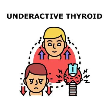 Underactive thyroid gland affecting health and mood Stock Illustration