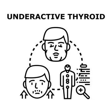 Underactive thyroid gland function diagnosis symptoms Stock Illustration