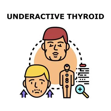 Underactive thyroid gland function diagnosis symptoms Stock Illustration