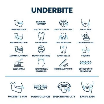 Underbite dental condition symptoms and causes infographic with icons for j.. Stock Illustration