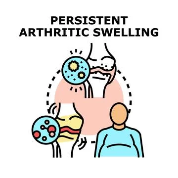 Understanding arthritic inflammation and joint swelling condition Illustrazione stock