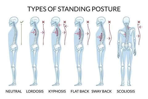 Understanding the Different Types of Standing Posture for Achieving Better Stock Illustration