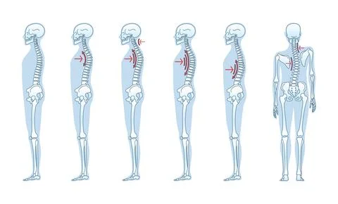 Understanding the Different Types of Standing Posture for Achieving Better Stock Illustration