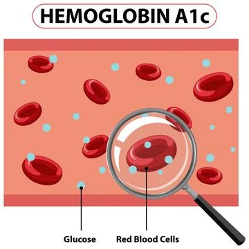 Understanding Hemoglobin A1c Levels Stock Illustration