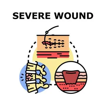 Understanding severe wound care and spinal injury concepts Stock Illustration