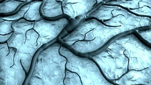 Understanding Stroke: Animated Explanation Stock Footage 269839751