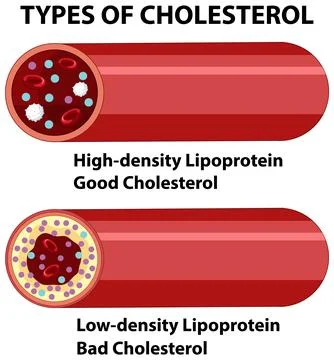 Understanding Types of Cholesterol Stock Illustration