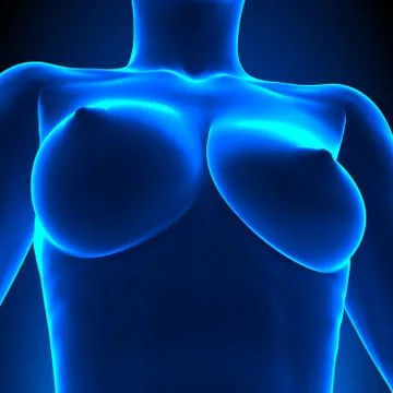 Uneven Breasts - different sizes Stock-Illustration