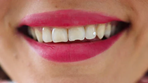 Uneven teeth with diamond stone Stock Footage 197553057