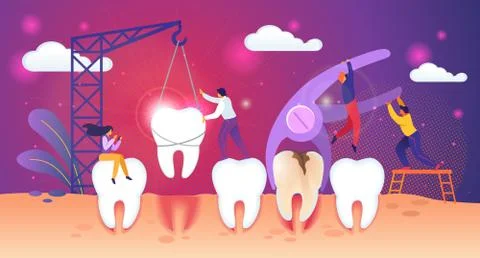 Unhealthy Tooth Removal Process. Tiny People Work 스톡 일러스트
