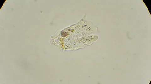 Unicellular amoeba motion under microscope 600x Video stock 35143181