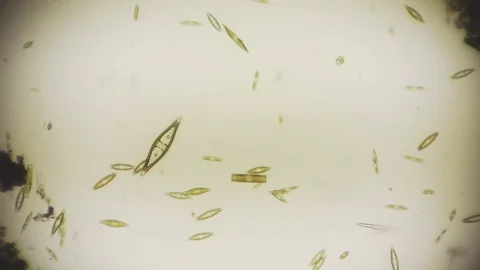 unicellular microorganism in pond water ... | Stock Video | Pond5