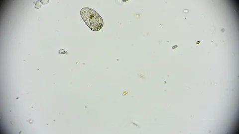 Unicellular Microorganisms Stock Footage ~ Royalty Free Stock Videos ...