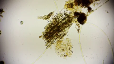 unicellular microorganism in pond water ... | Stock Video | Pond5