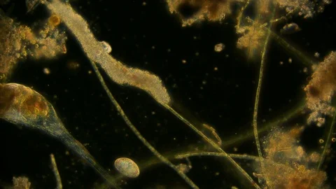 unicellular microorganism in pond water ... | Stock Video | Pond5