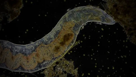 unicellular microorganism in pond water ... | Stock Video | Pond5