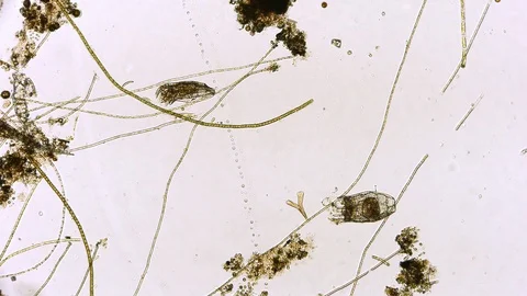 unicellular microorganism in pond water ... | Stock Video | Pond5