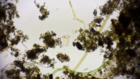 unicellular microorganism in pond water ... | Stock Video | Pond5