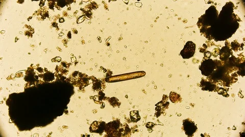 unicellular microorganism in pond water ... | Stock Video | Pond5