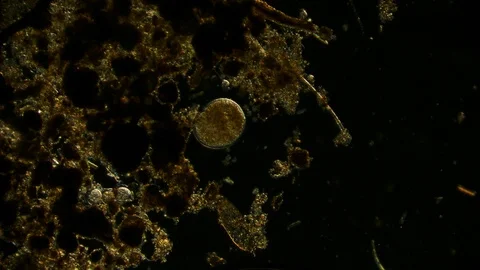 unicellular microorganism in pond water ... | Stock Video | Pond5