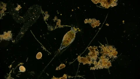 unicellular microorganism in pond water ... | Stock Video | Pond5