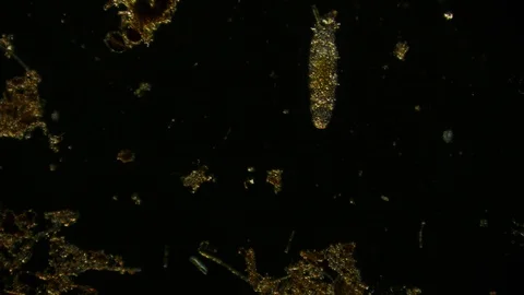 unicellular microorganism in pond water ... | Stock Video | Pond5