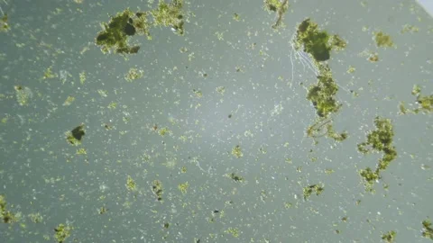 Unicellular organisms and algae  under microscope magnification freshwater Stock Footage 142578113