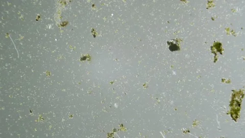 Unicellular organisms and algae  under microscope magnification freshwater Stock Footage 142578116