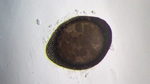 Unidentified microscopic seed, surrounded by bacteria Stock Footage 56305773