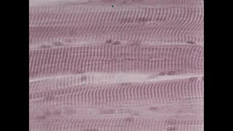 UNITED STATES 1960s: Pointer by anatomical drawing of muscles on body. Magnified Stock Footage 307944556