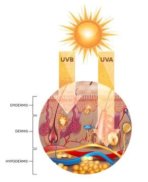 Unprotected skin without sunscreen lotion Stock Illustration