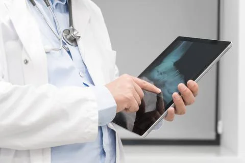 Unrecognizable Doctor is checking x-ray image at computer tablet, close up Stock Photos