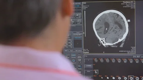 Unrecognizable Doctor examines a head MRI scan on a computer screen Stock Footage
