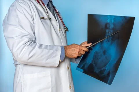 Unrecognizable doctor pointing a metal pointer at a person's hip X-ray Stock Photos