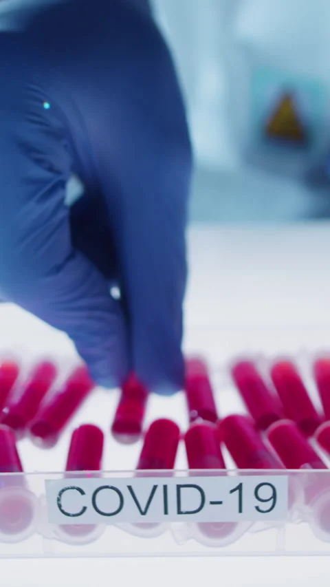 Unrecognizable Gloved Hand Putting Down Blood Sample Test Tube to Tray in Lab Stock Footage 315283507