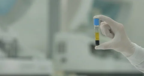 Unrecognizable laboratory assistant in glows showing test tube with yellow Stock Footage 150487143