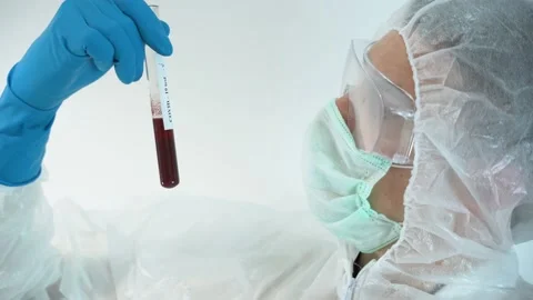 Unrecognizable man makes test, glass beaker with blood, reads inscription Stock Footage 131478100