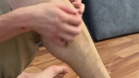 Unrecognizable man scratching shin close-up, skin irritation and dermatology Stock Footage 337355095