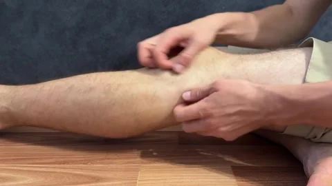 Unrecognizable man scratching side of shin close-up, concept of itching, rash, Stock Footage 337355090